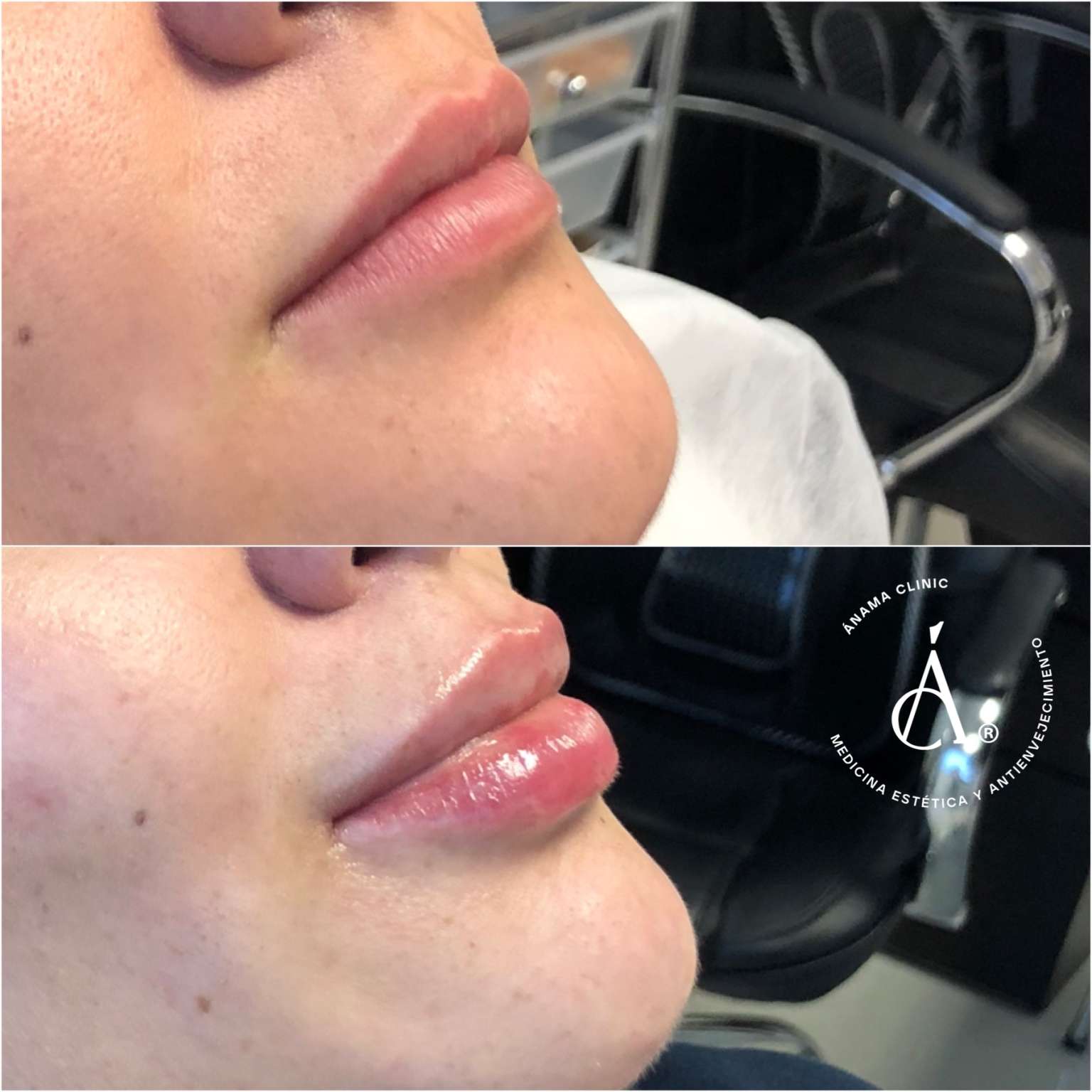 Antes y Después
