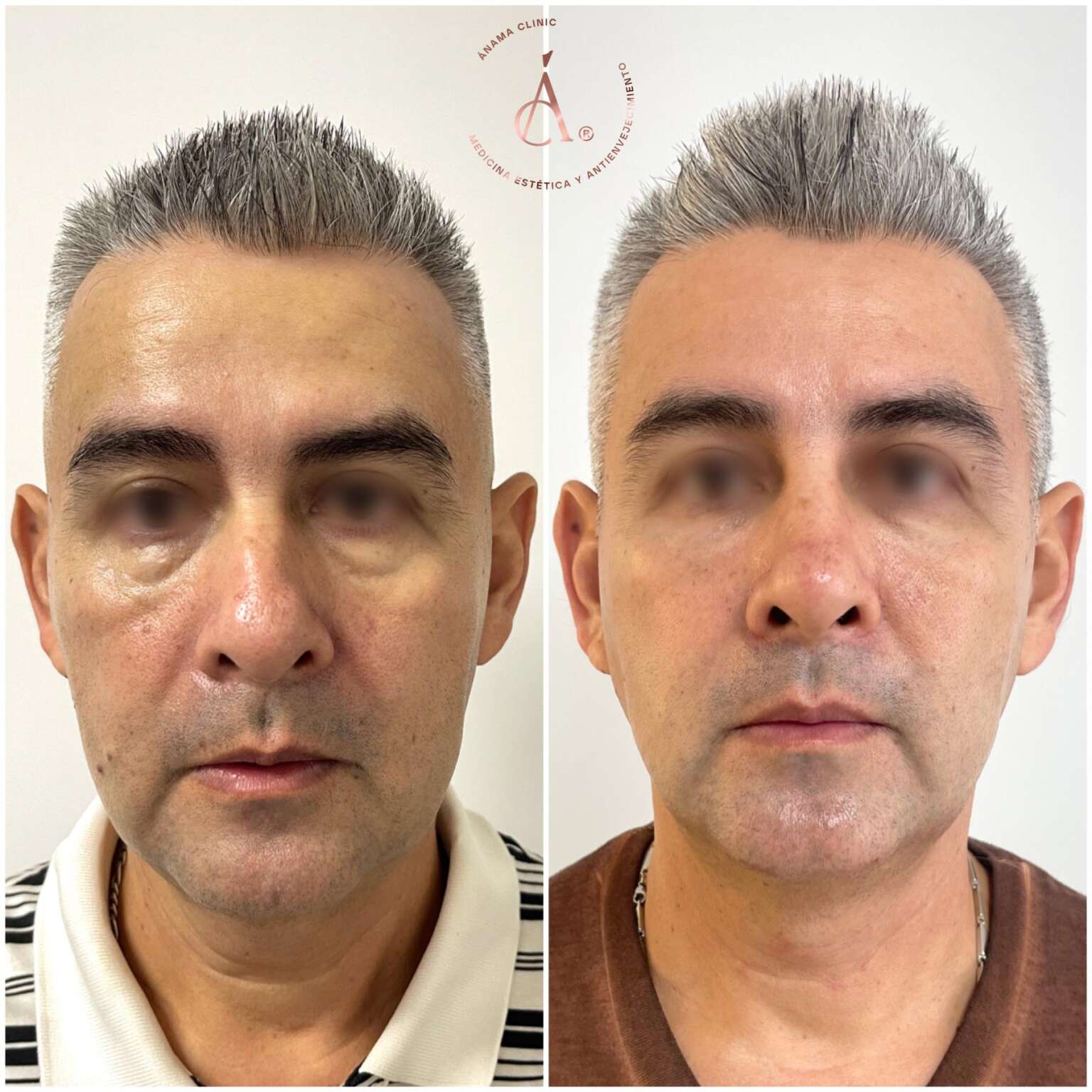 Antes y Después