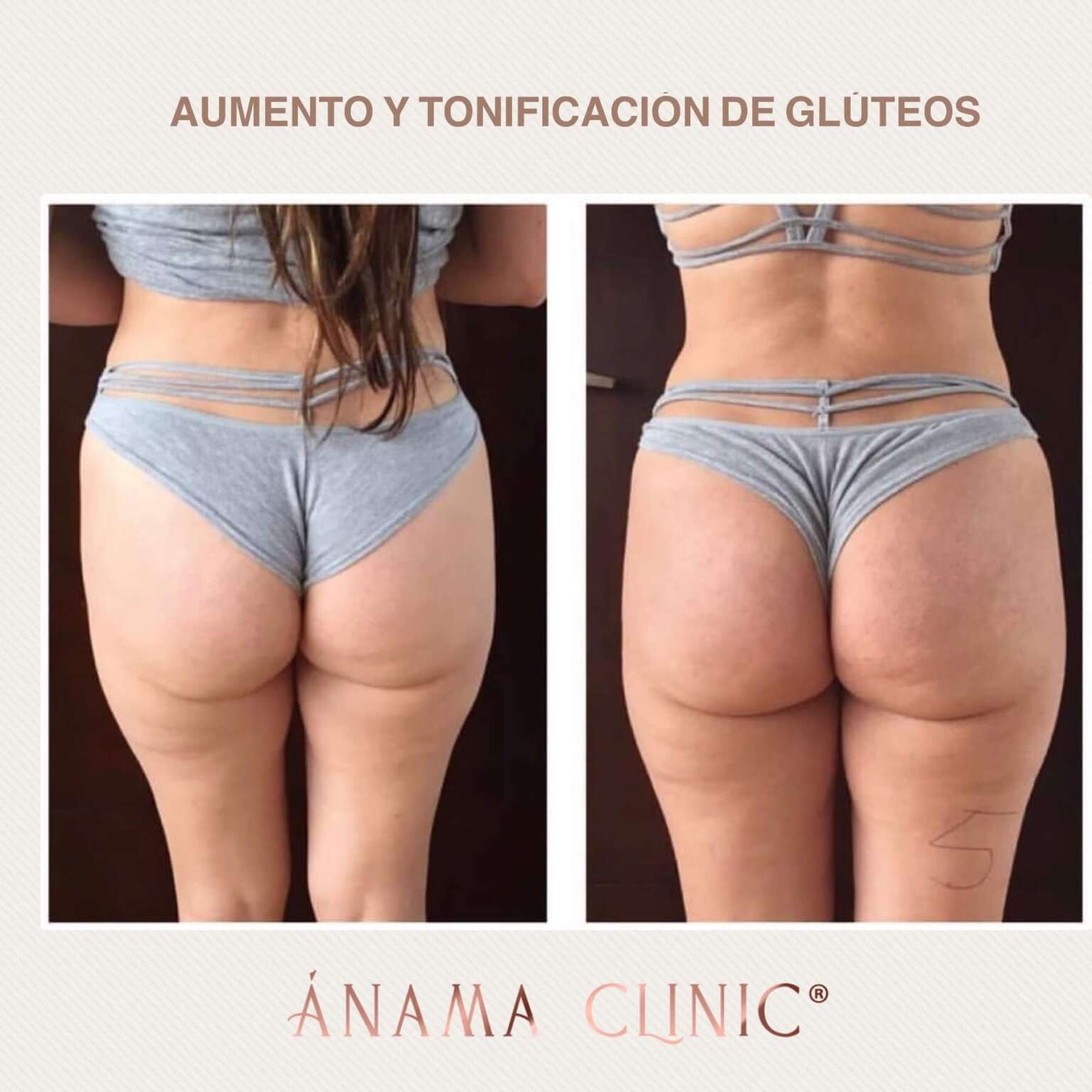 Antes y Después